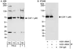 Detection of human CAF-1 p60 by western blot and immunoprecipitation.