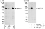 Detection of human NUP210 by western blot and immunoprecipitation.