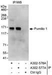 Detection of human Pumilio 1 by western blot of immunoprecipitates.