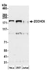 Detection of human ZCCHC6 by western blot.