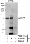 Detection of human E2F7 by western blot of immunoprecipitates.