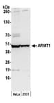 Detection of human ARMT1 by western blot.