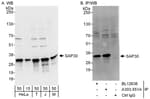 Detection of human and mouse SAP30 by western blot (h and m) and immunoprecipitation (h).