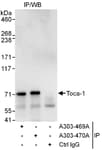 Detection of human Toca-1 by western blot of immunoprecipitates.