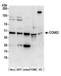 Detection of human and mouse CCNE2 by western blot.