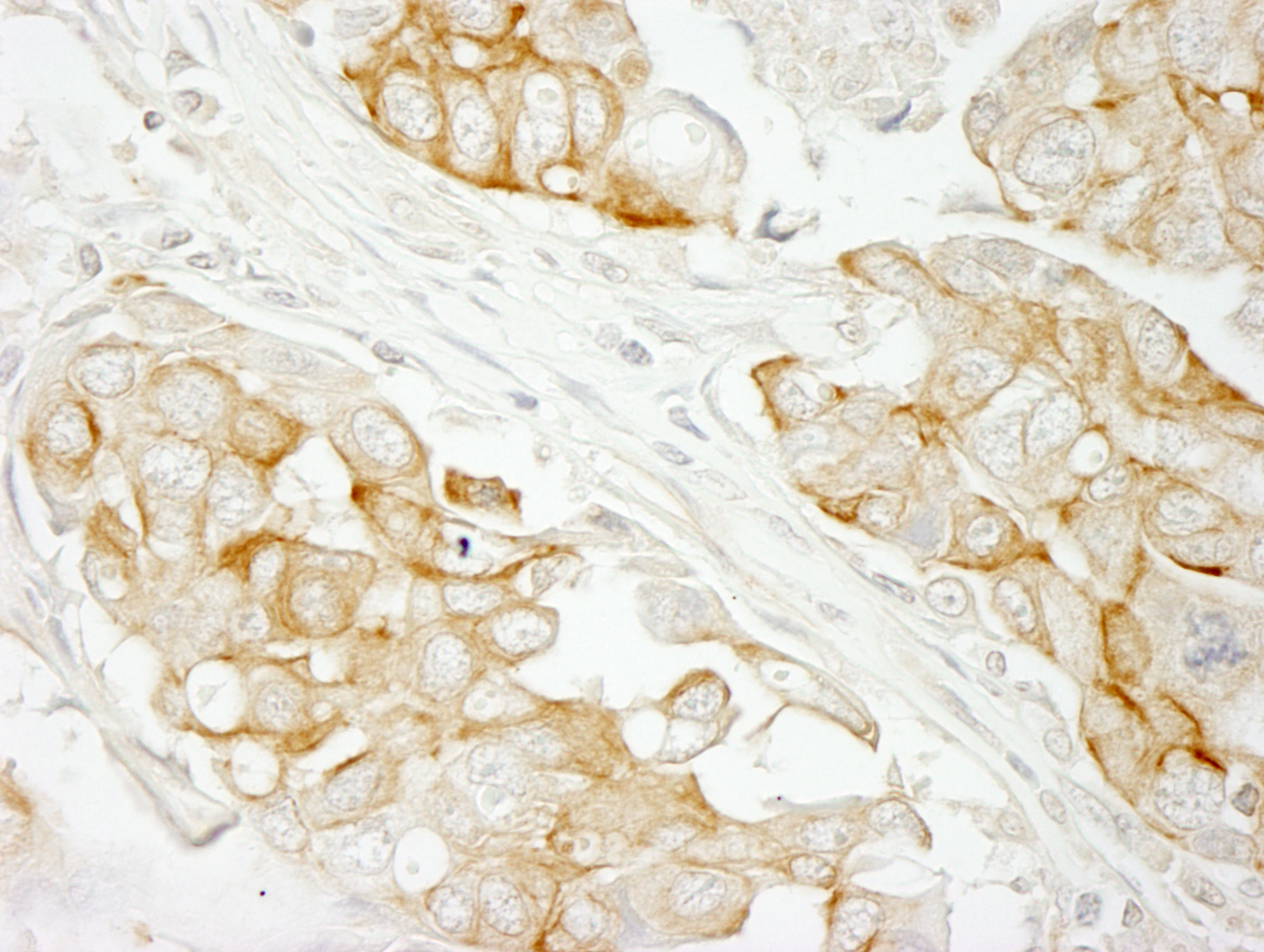 Rabbit anti-Notch2 IHC Antibody