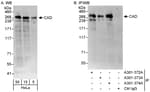 Detection of human CAD by western blot and immunoprecipitation.