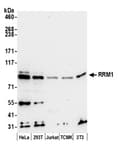 Detection of human and mouse RRM1 by western blot.