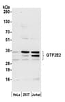 Detection of human GTF2E2 by western blot.
