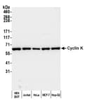 Detection of human Cyclin K by western blot.