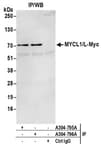 Detection of human MYCL1/L-Myc by western blot of immunoprecipitates.