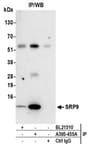 Detection of human SRP9 by western blot of immunoprecipitates.