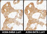 Detection of human ADE2 by immunohistochemistry.