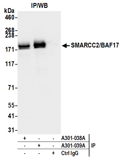Detection of human SMARCC2/BAF170 by western blot of immunoprecipitates.