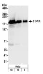 Detection of human EGFR by western blot.