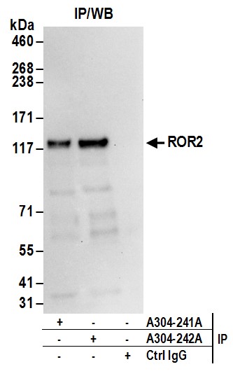 Detection of human ROR2 by western blot of immunoprecipitates.