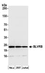 Detection of human BLVRB by western blot.