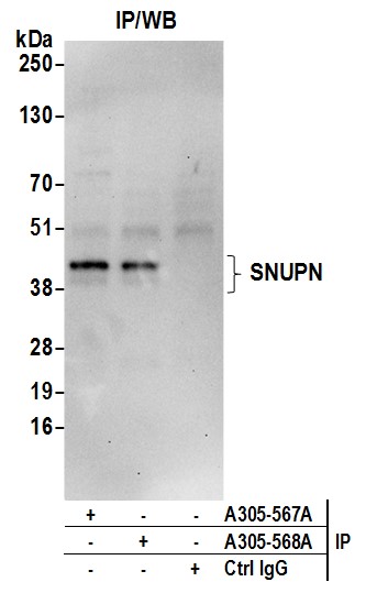 Detection of human SNUPN by western blot of immunoprecipitates.