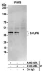 Detection of human SNUPN by western blot of immunoprecipitates.
