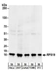 Detection of human and mouse RPS19 by western blot.