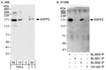 Detection of human ASPP2 by western blot and immunoprecipitation.