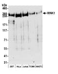 Detection of human and mouse WNK1 by western blot.
