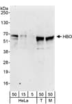 Detection of human and mouse HBO by western blot.