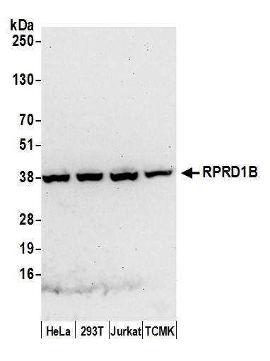 Detection of human and mouse RPRD1B by western blot.