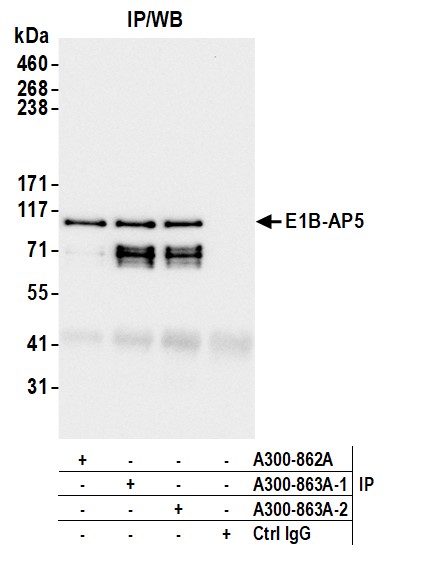Rabbit anti-E1B-AP5 Antibody, Affinity Purified, image 2