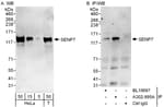 Detection of human SENP7 by western blot and immunoprecipitation.