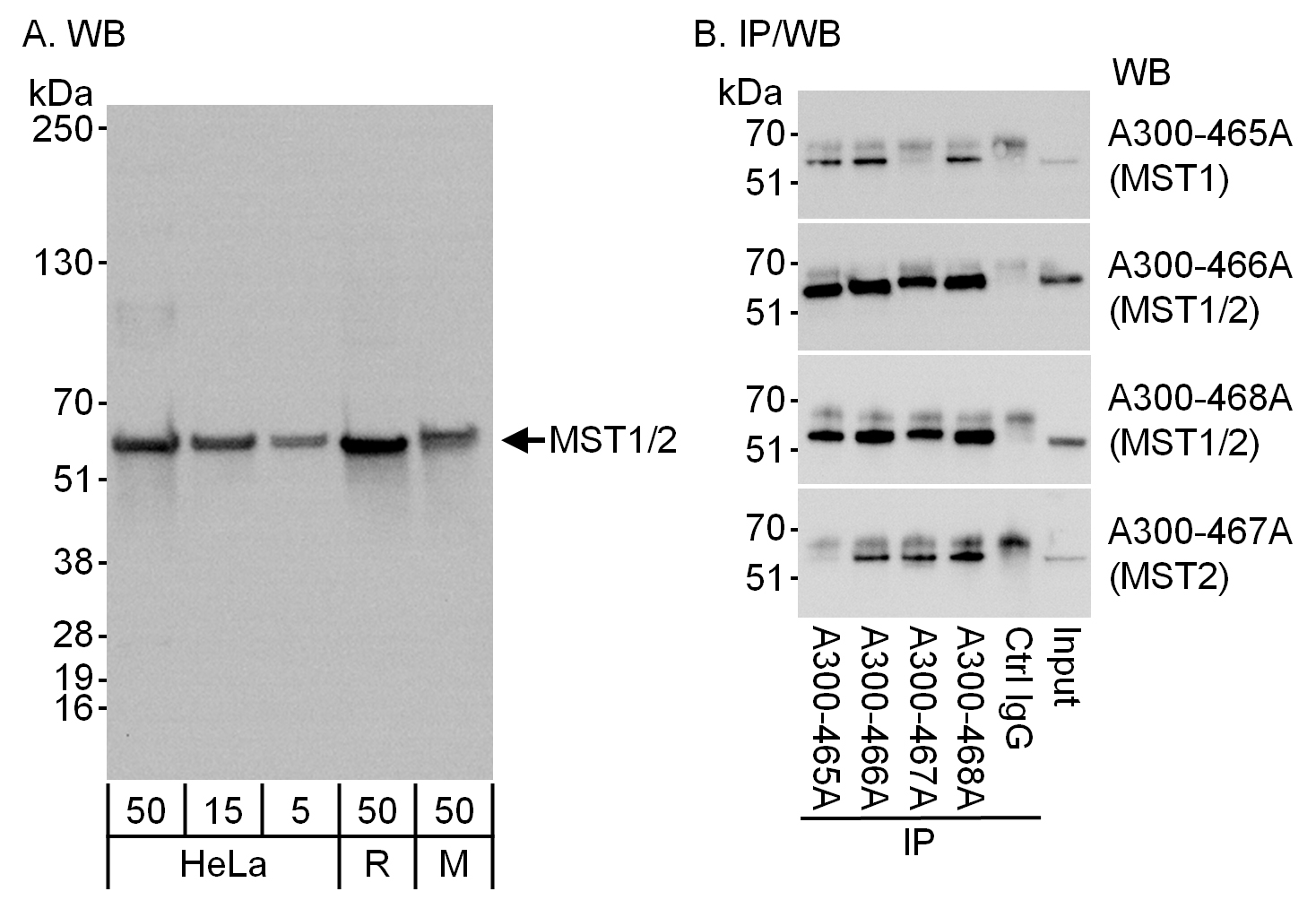 Detection of MST1 and MST2 by western blot and immunoprecipitation.