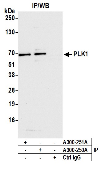 Detection of human PLK1 by western blot of immunoprecipitates.