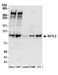 Detection of human and mouse SCYL2 by western blot.