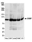 Detection of human and mouse OSBP by western blot.