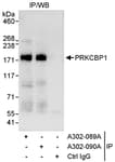 Detection of human PRKCBP1 by western blot of immunoprecipitates.