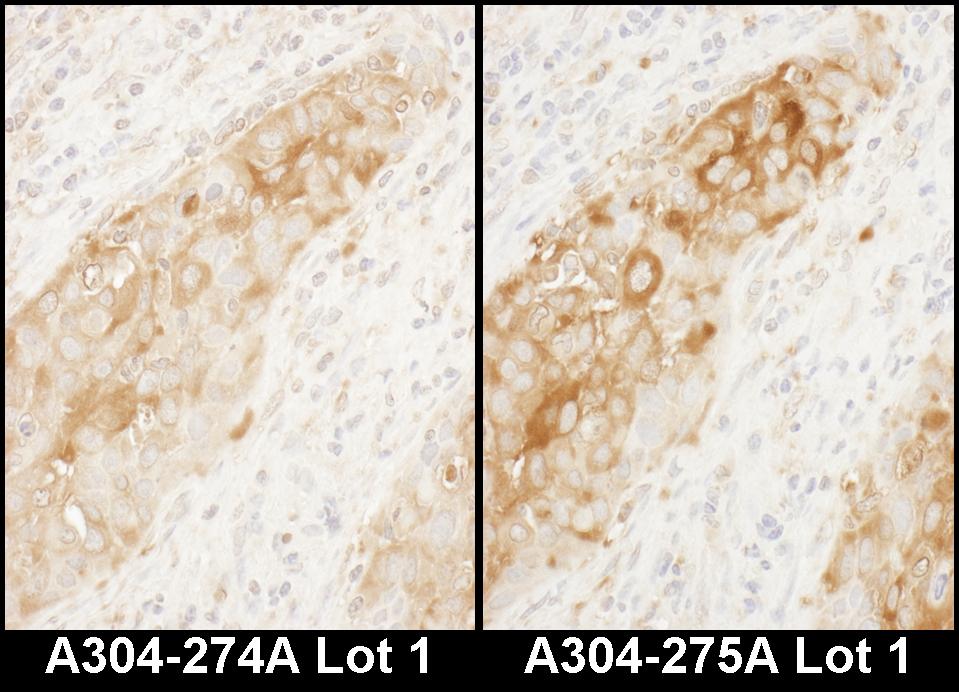 Detection of human WARS by immunohistochemistry.