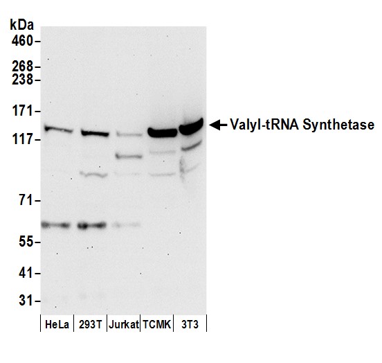 Detection of human and mouse Valyl-tRNA Synthetase/VARS by western blot.