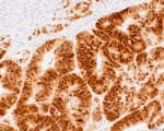 Detection of human CDX2 by immunohistochemistry.
