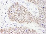 Detection of human PHF6 by immunohistochemistry.