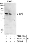 Detection of human ZEB2/SIP by western blot of immunoprecipitates.