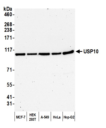 Detection of human USP10 by western blot.