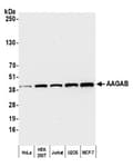 Detection of human AAGAB by western blot.