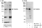 Detection of human FAM65A by western blot and immunoprecipitation.