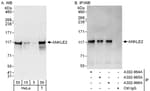 Detection of human ANKLE2 by western blot and immunoprecipitation.