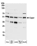 Detection of human Caper by western blot.