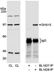 Detection of human DHX15 by western blot and immunoprecipitation.