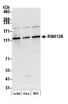 Detection of human RBM12B by western blot.