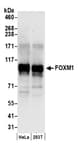 Detection of human FOXM1 by western blot.