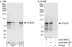 Detection of human CCDC8 by western blot and immunoprecipitation.
