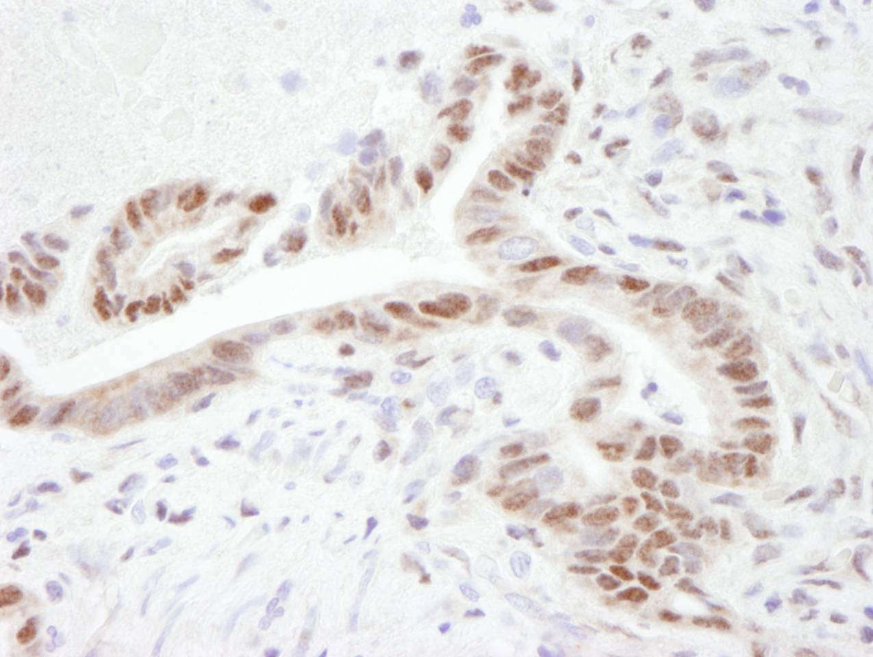 Detection of human PGC-1 by immunohistochemistry.